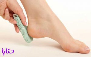 cracked heel 9 300x191 - 13 علت ایجاد ترک پا و درمان های موثر