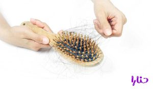 anti hair loss 300x175 - علت ریزش مو در جوانان