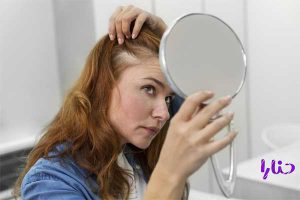 woman getting hair loss tre 300x200 - معرفی ده شامپو ضد ریزش مو