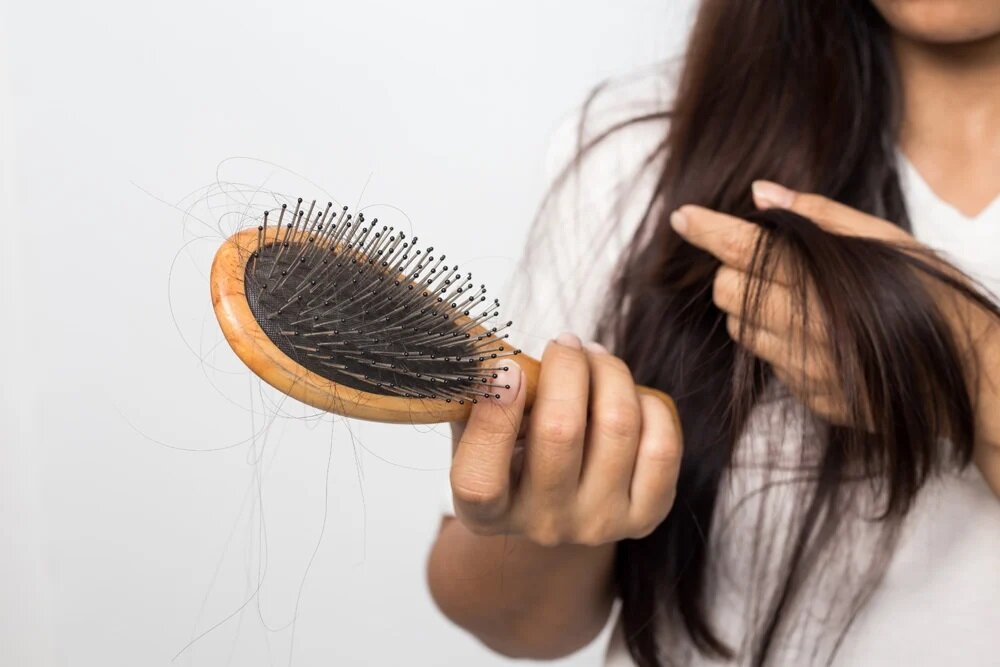 ریزش مو حنارا - چرا دچار ریزش مو می‌شویم ؟